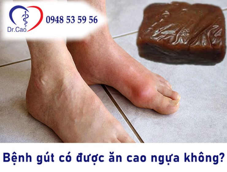 Giải đáp: Bệnh gút có ăn được cao ngựa bạch không?