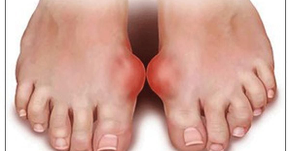 Dù cao mèo rất tốt, nhưng một số người không nên sử dụng dược liệu này
