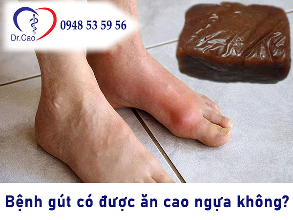Bệnh gút có ăn được cao ngựa bạch không?
