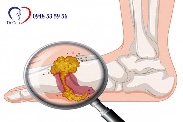Cao ngựa bạch có tác dụng gì đối với sức khoẻ